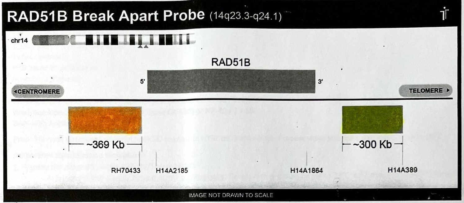 RAD51B break apart probe